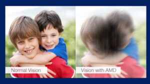 Focus on vision this Macula Month